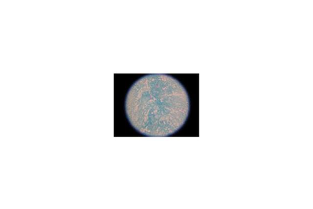 Reagent, AFB